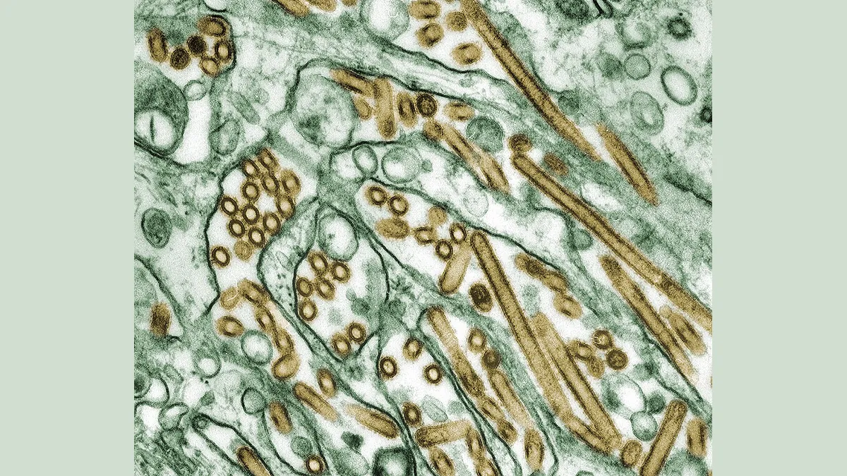 Символна снимка: вируси на птичия грип A(H5N1) под електронен микроскоп (оцветено)